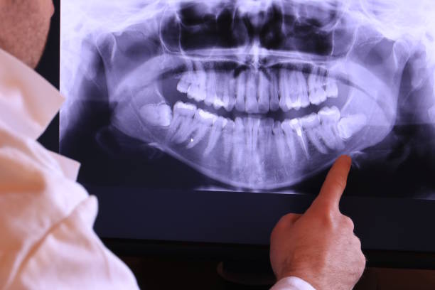 Best Emergency Treatment for Jaw Pain or Injury in Frankton, IN