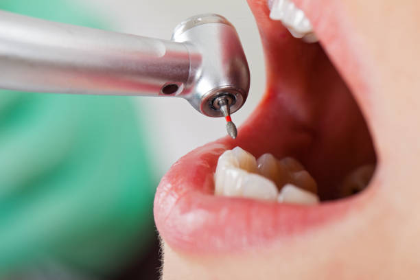 Best Walk-In Emergency Dental Services in Frankton, IN